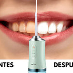 Irrigador Bucal +ENVÍO GRATIS