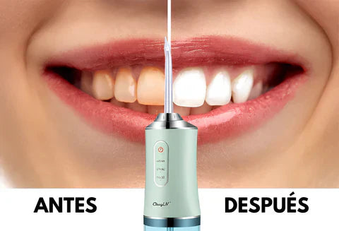 Irrigador Bucal +ENVÍO GRATIS