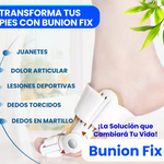 Corrector de Juanetes Ajustable Bunion Fix Pro