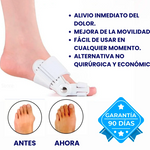 Corrector de Juanetes Ajustable Bunion Fix Pro