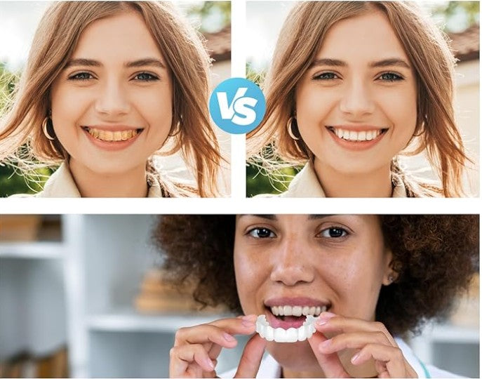 CARILLAS DENTALES+ ENVIO GRATIS