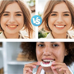 CARILLAS DENTALES+ ENVIO GRATIS