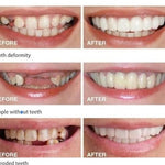 CARILLAS DENTALES+ ENVIO GRATIS