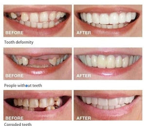CARILLAS DENTALES+ ENVIO GRATIS