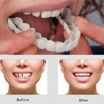 CARILLAS DENTALES+ ENVIO GRATIS