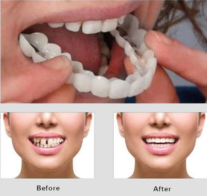 CARILLAS DENTALES+ ENVIO GRATIS