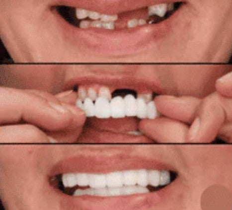 CARILLAS DENTALES+ ENVIO GRATIS