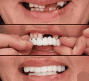 CARILLAS DENTALES+ ENVIO GRATIS