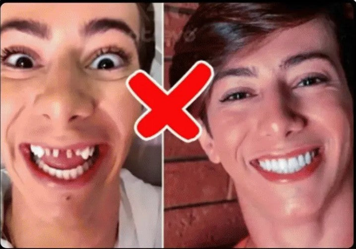 CARILLAS DENTALES+ ENVIO GRATIS