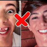 CARILLAS DENTALES+ ENVIO GRATIS