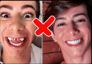 CARILLAS DENTALES+ ENVIO GRATIS