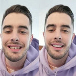 CARILLAS DENTALES+ ENVIO GRATIS