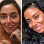 CARILLAS DENTALES+ ENVIO GRATIS