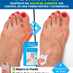 Corrector de Juanetes Ajustable Bunion Fix Pro